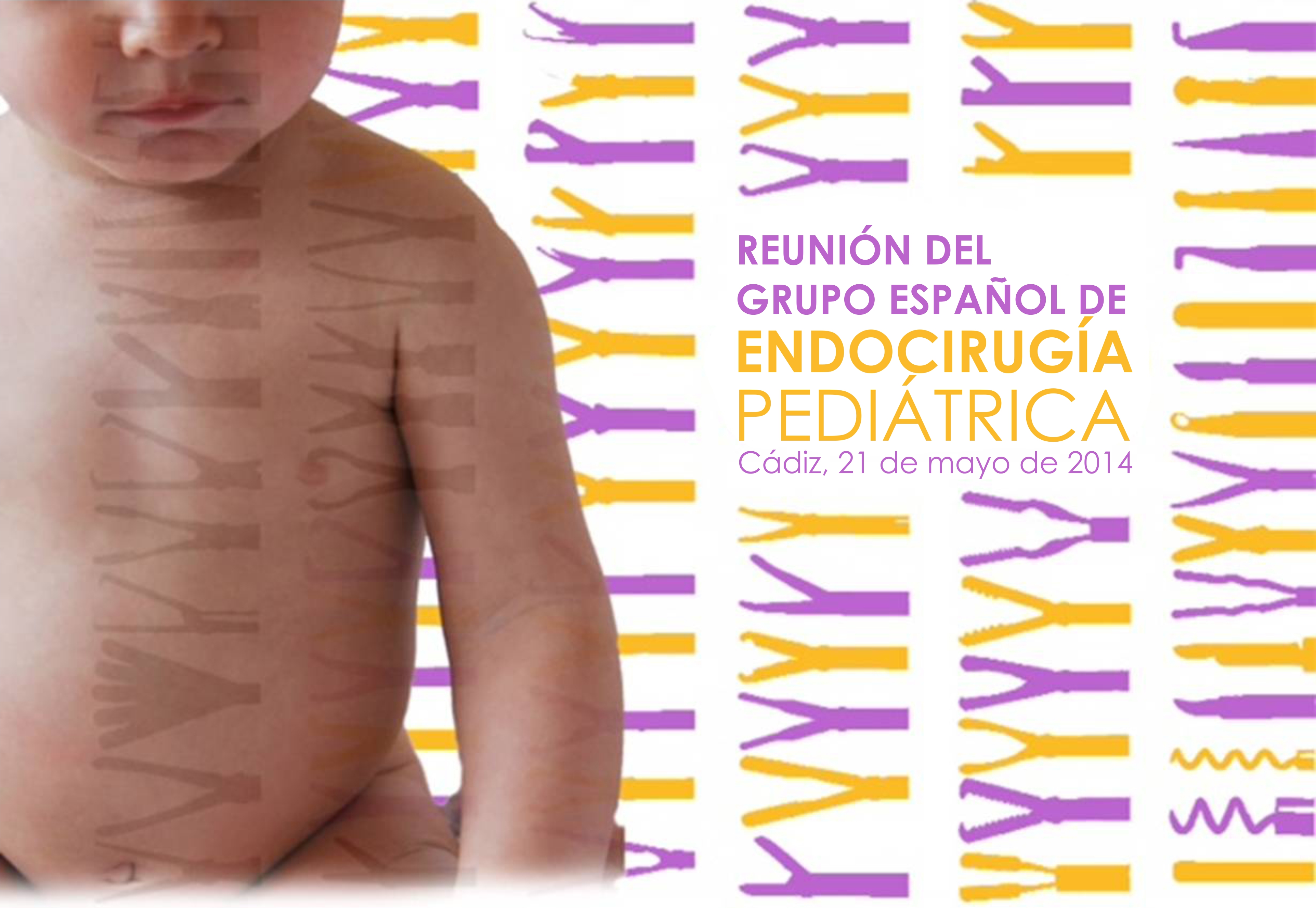 Reunión del Grupo Español de Endocirugía Pediátrica